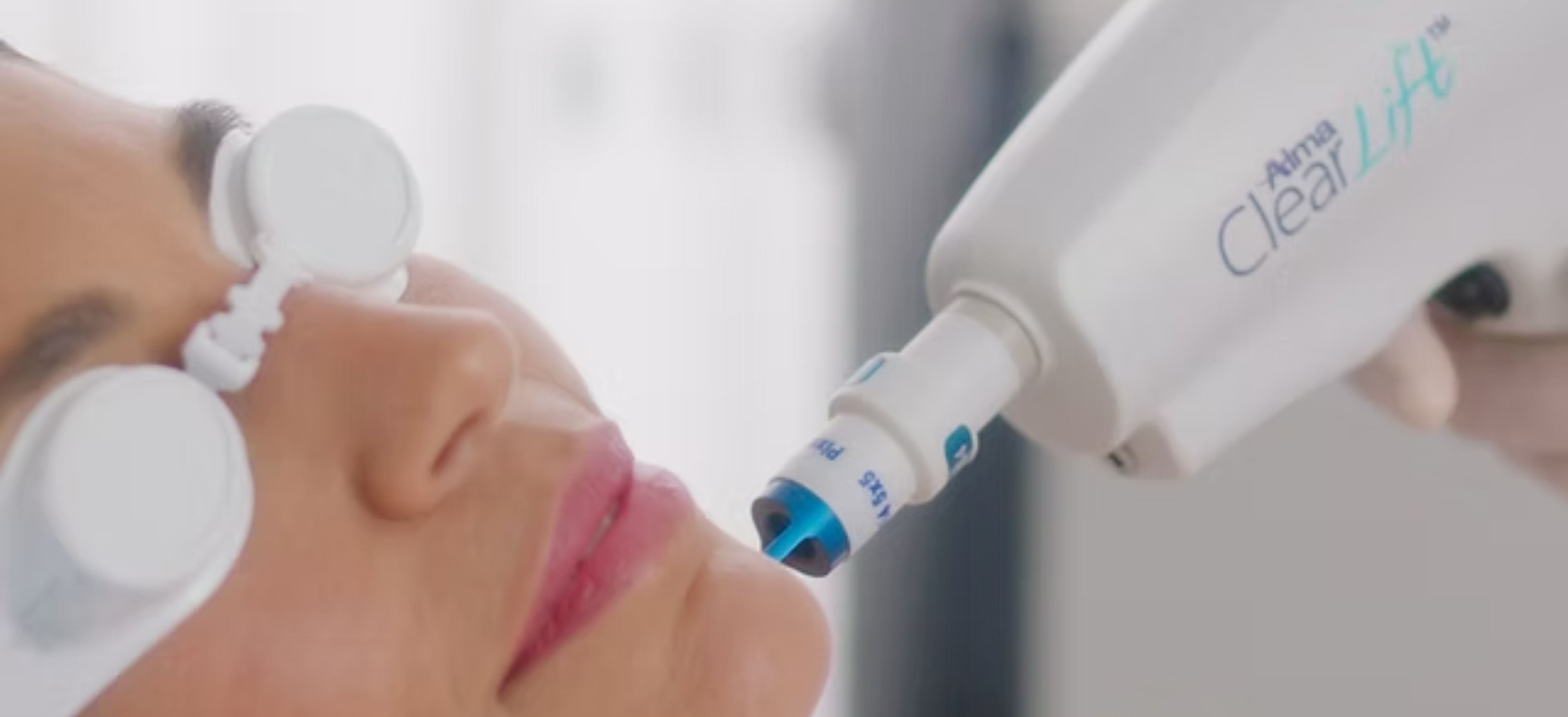 ClearLift Lesion Removal