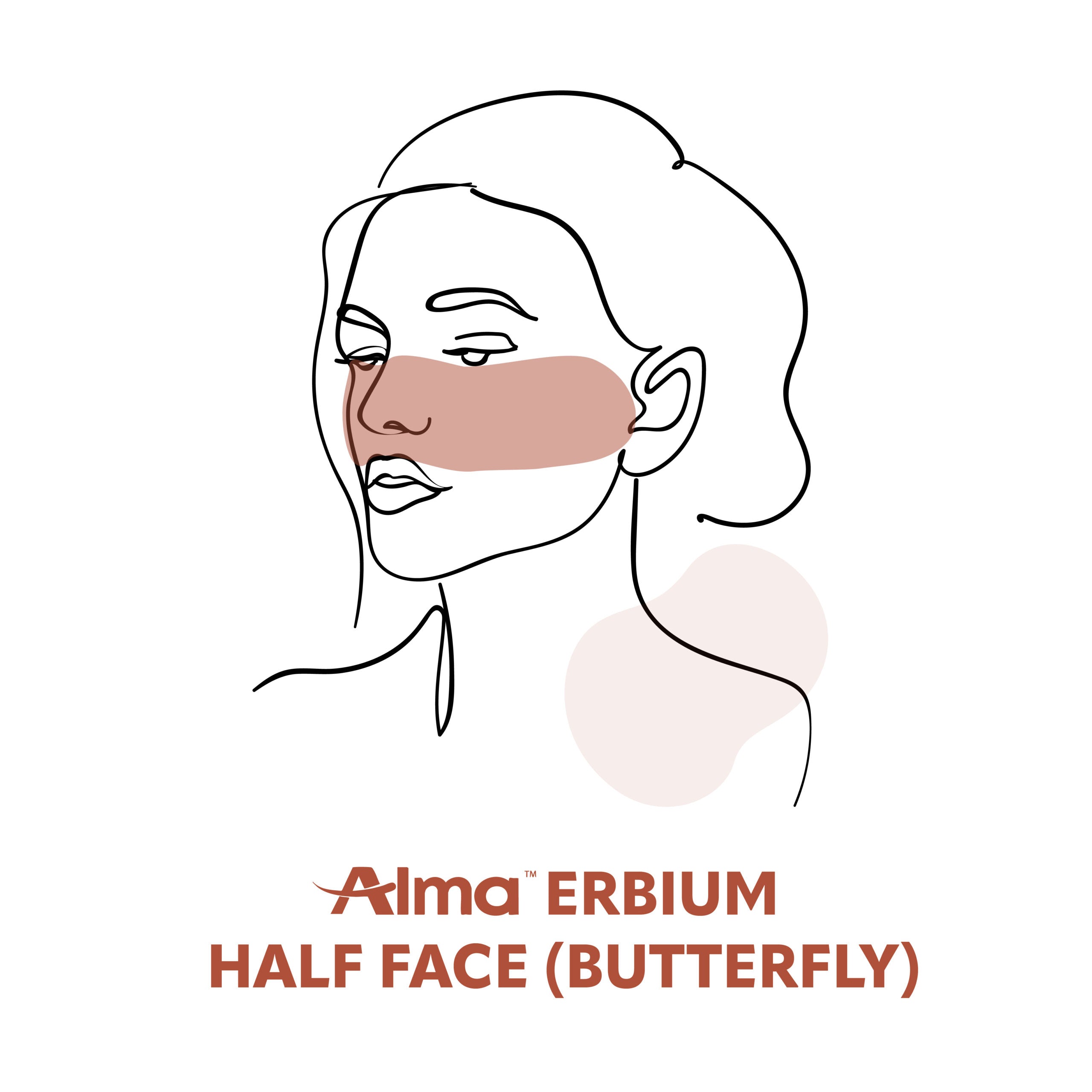 Erbium Half Face (Butterfly)
