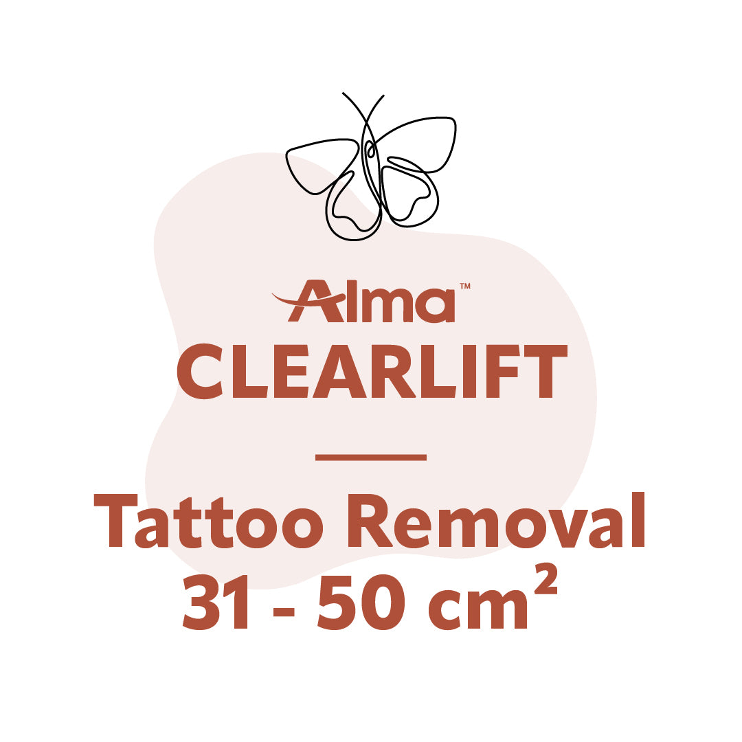 ClearLift Tattoo Removal 31 - 50 cm²