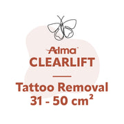 ClearLift Tattoo Removal 31 - 50 cm²
