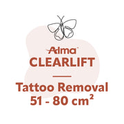 ClearLift Tattoo Removal 51 - 80 cm²