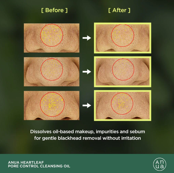 Anua Heartleaf Pore Control Cleansing Oil