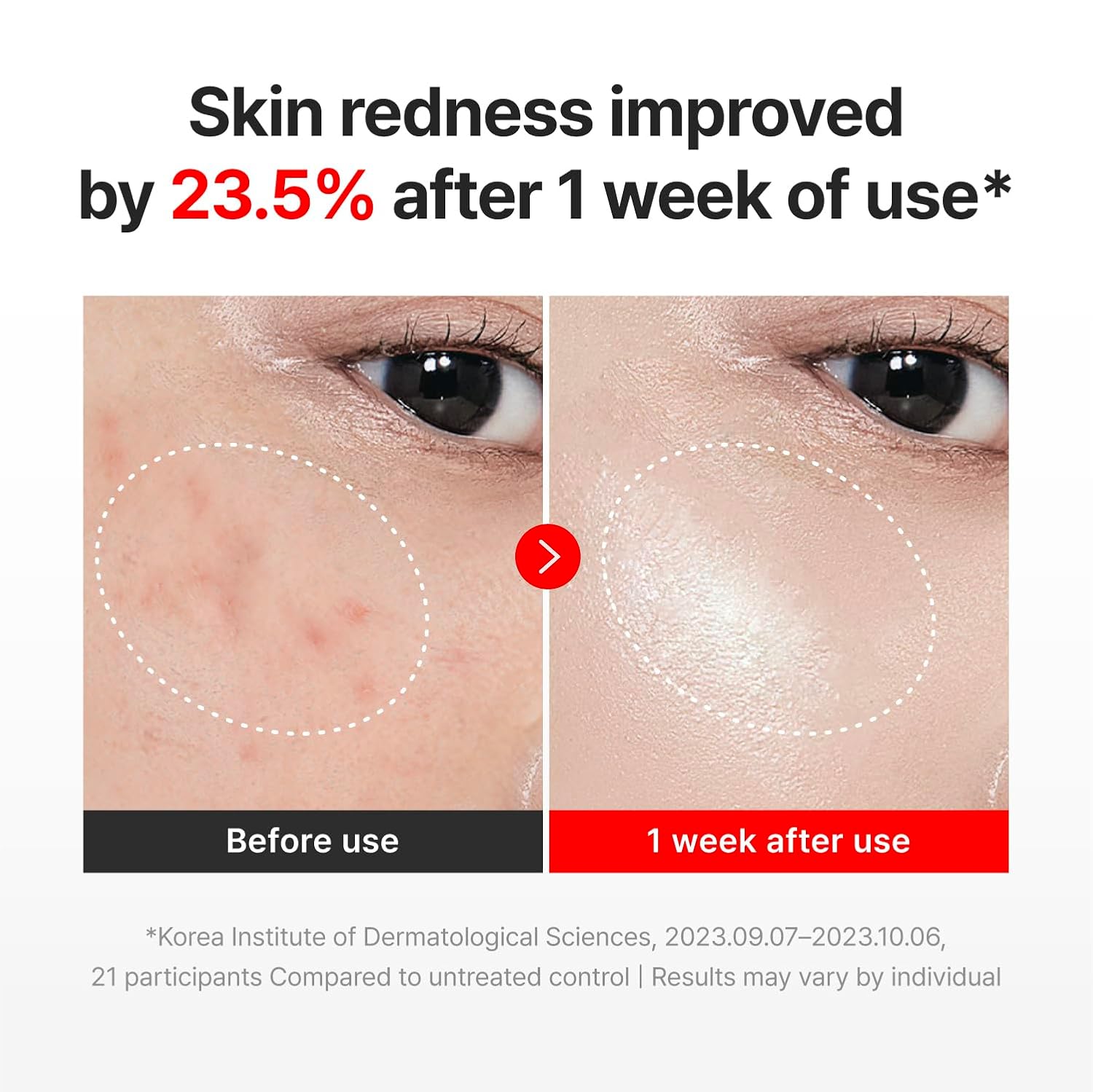 Centellian24  Madeca Cream Time Reverse