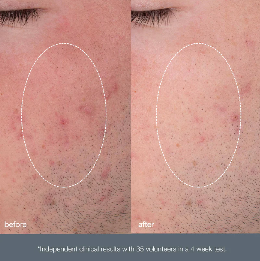 Dermalogica Daily Microfoliant