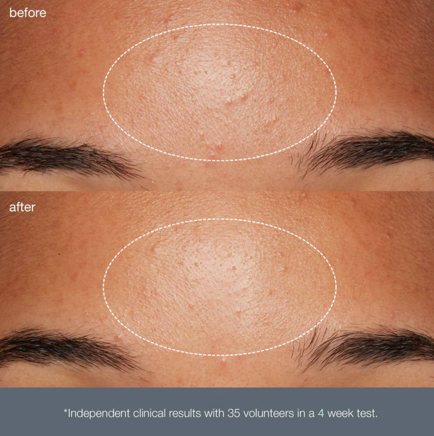 Dermalogica Daily Microfoliant