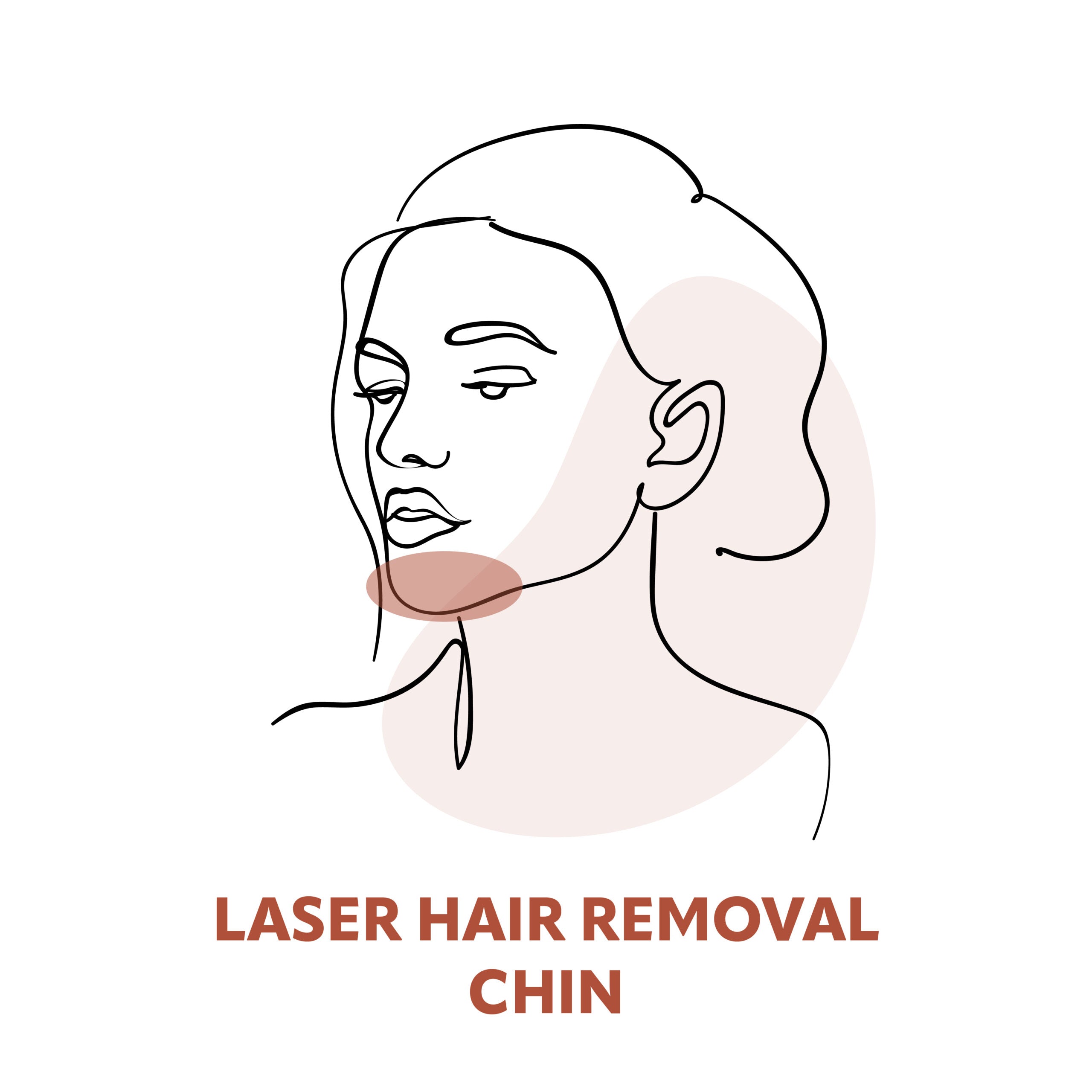 Chin Laser Hair Removal Treatments