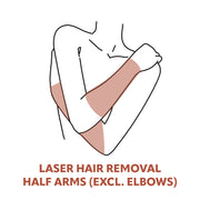 Half Arm Laser Hair Removal Treatments