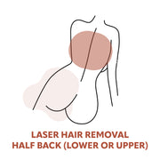 Half-Back Laser Hair Removal Treatments