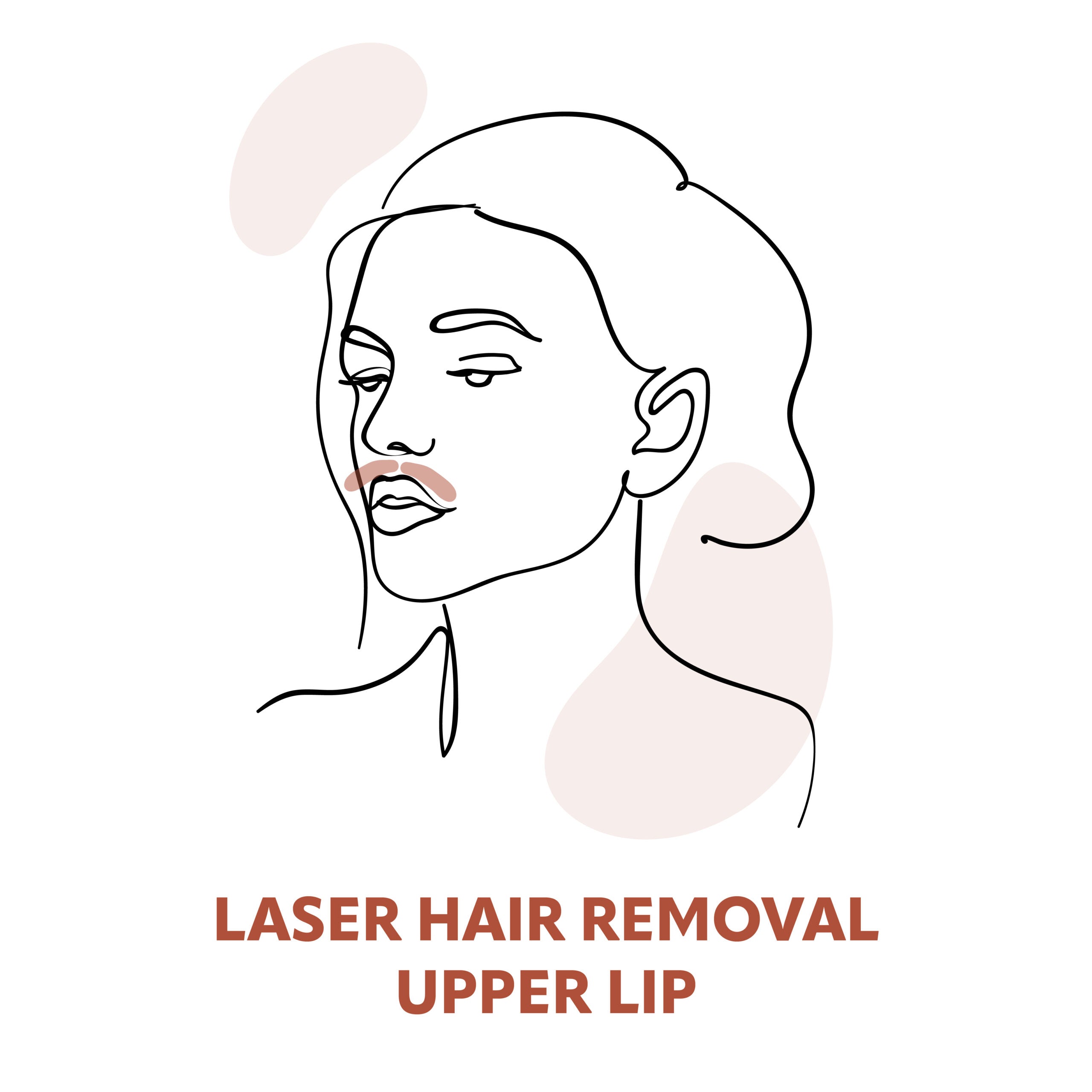 Upper Lip Laser Hair Removal Treatments