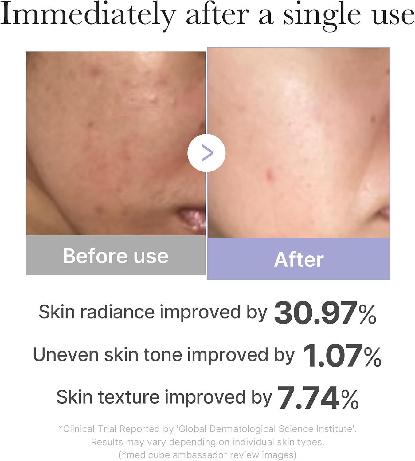 Medicube AGE-R Booster Pro Mini Plus