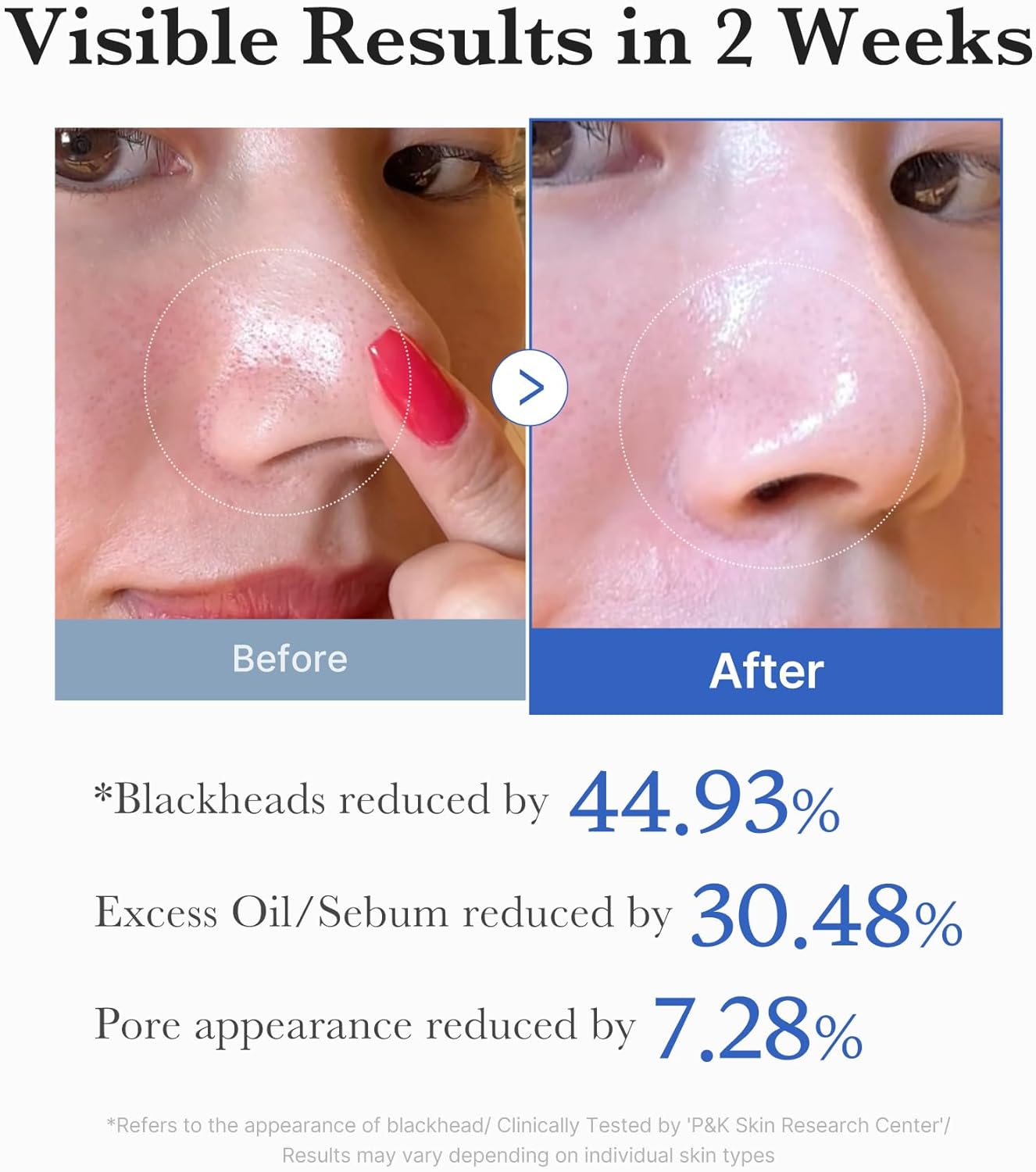 Medicube Zero Pore Pad 2.0