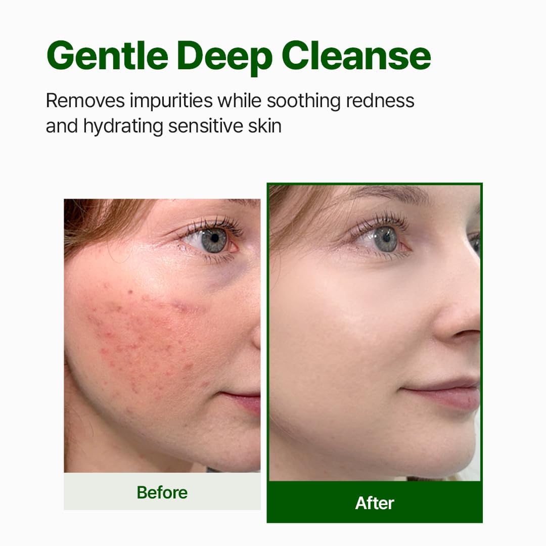 Nacific Cica + PDRN Gel Cleanser
