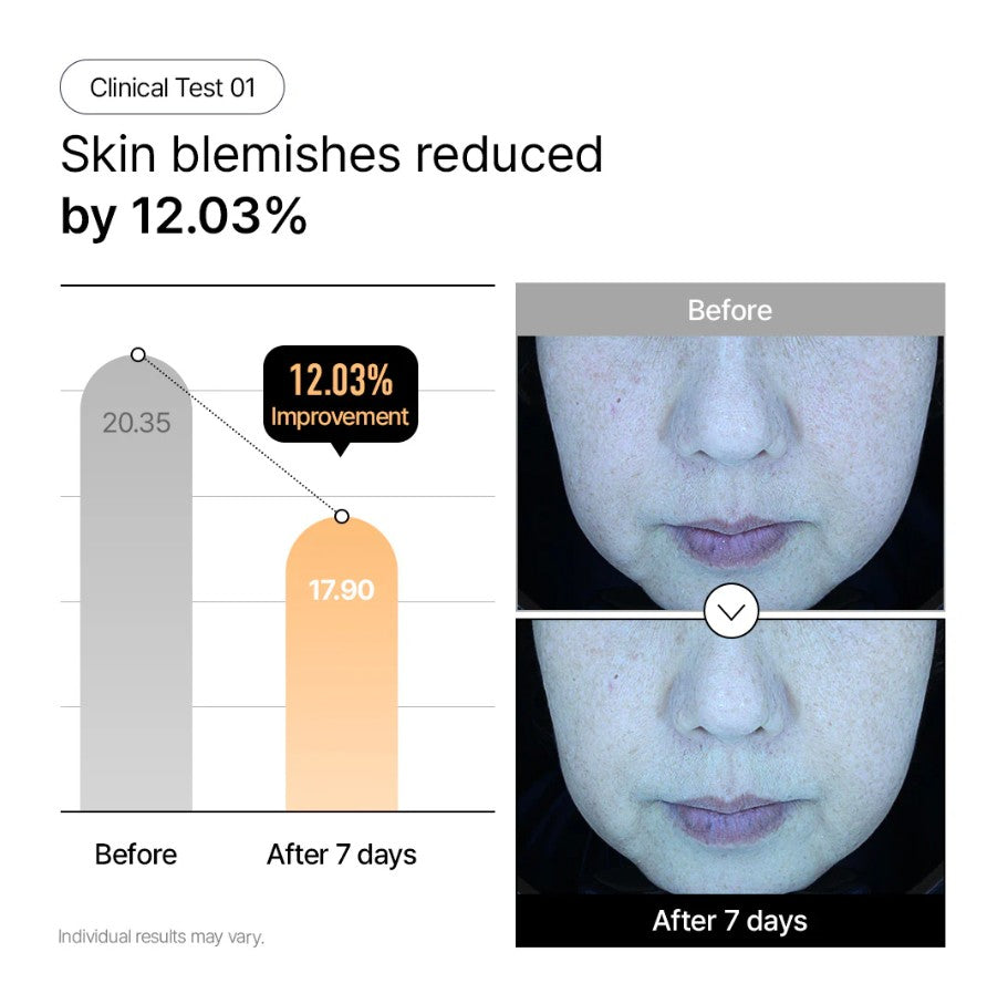 Parnell Niacinamide and Rice Brightening Gel Mask