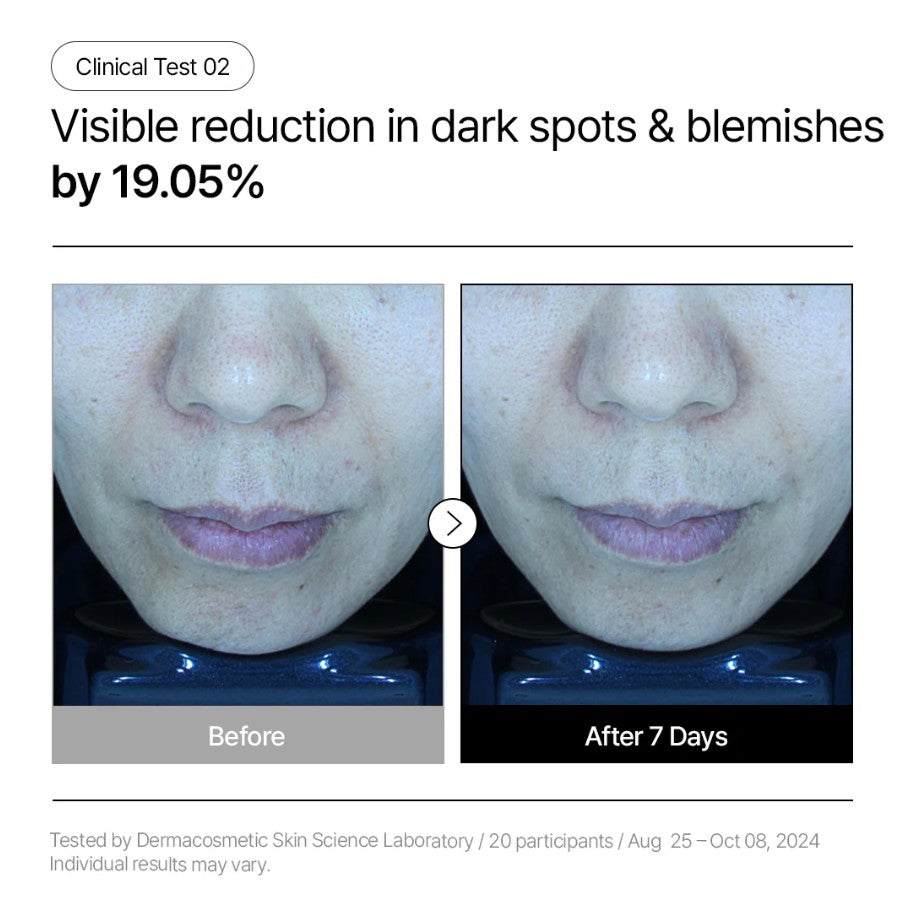 Parnell Niacinamide and Rice Brightening Serum