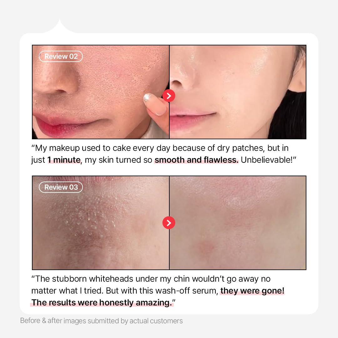 Parnell AHA and Omija Ceramic Wash-Off Serum