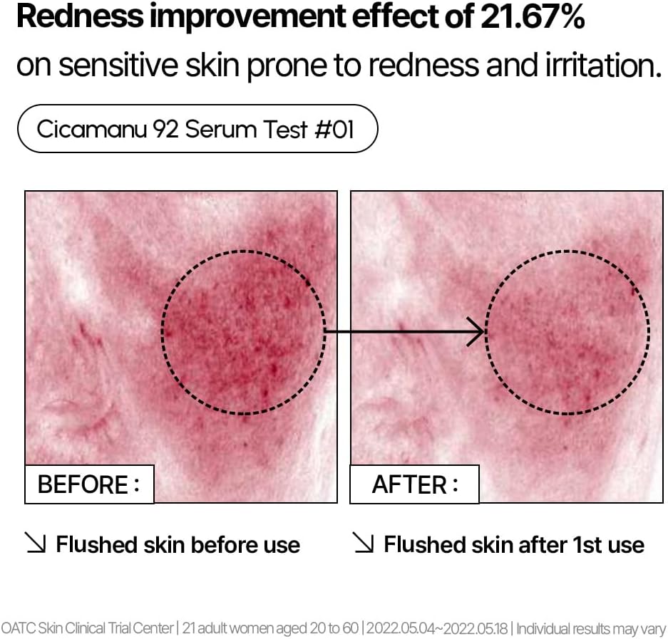Parnell Cicamanu 92 Serum