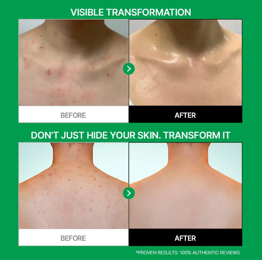 Parnell Cicamanu pH Balanced Body Mist