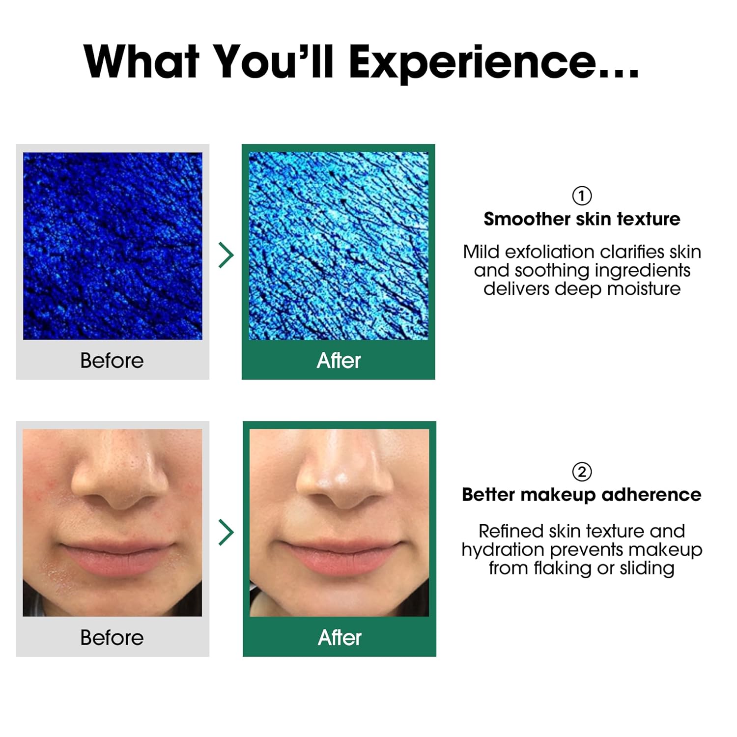 Some By Mi AHA BHA PHA 30 Days Miracle Toner