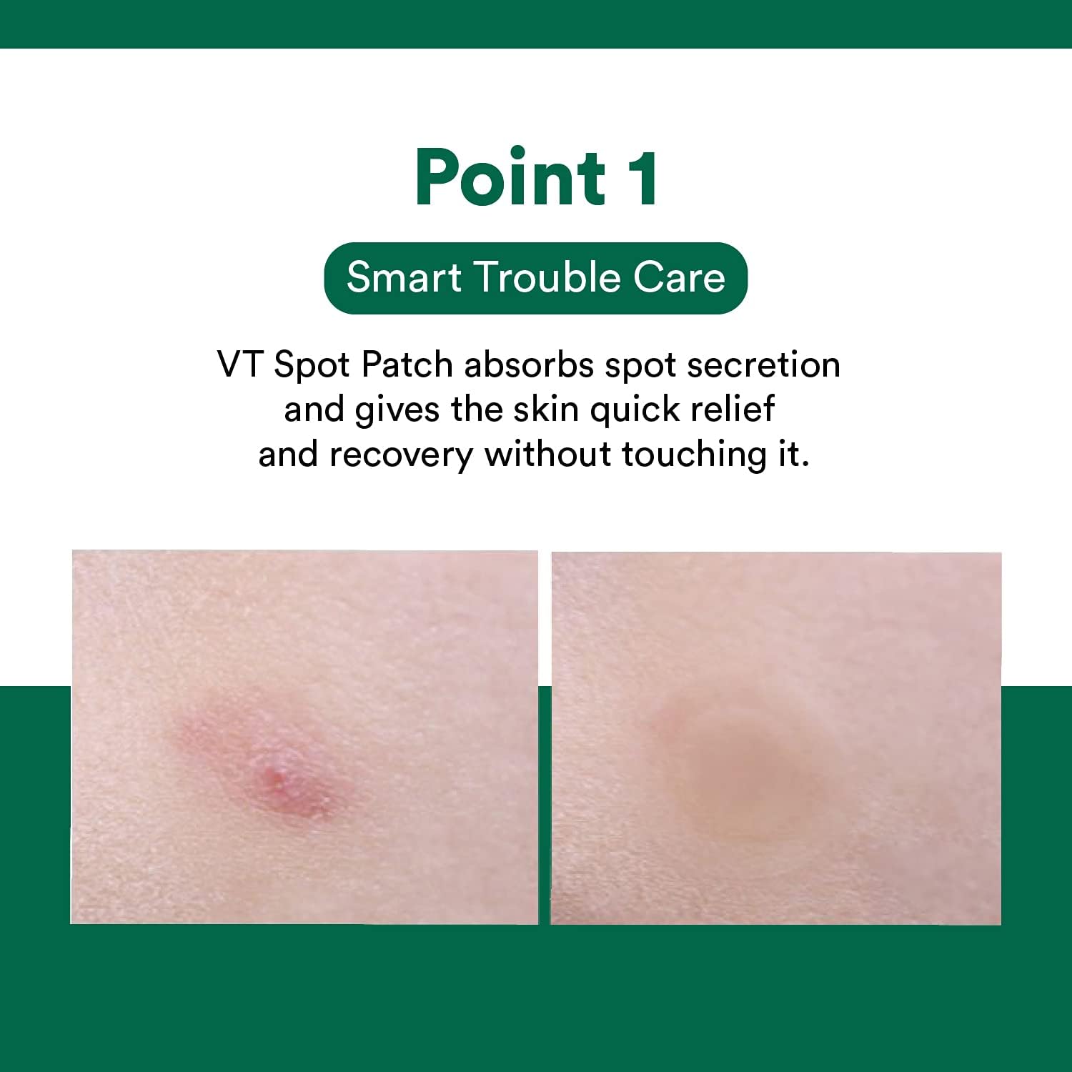 VT Cica Spot Patch