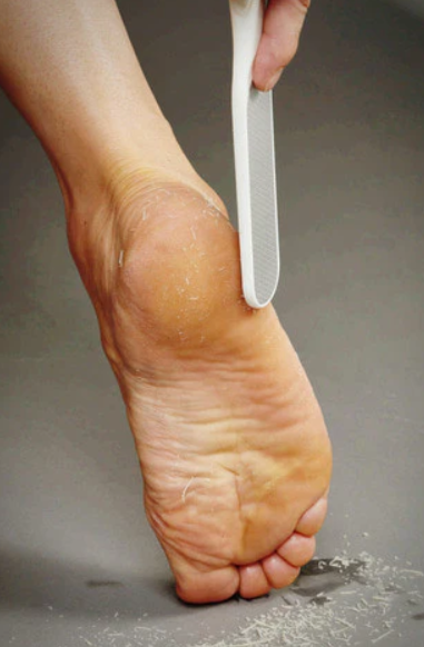 Baren Foot Callus Eraser Home Set