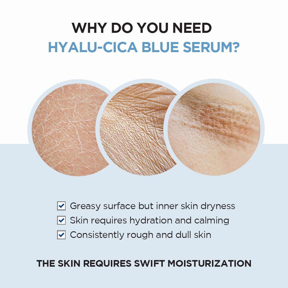 Skin1004 Madagascar Centella Hyalu-Cica Blue Serum