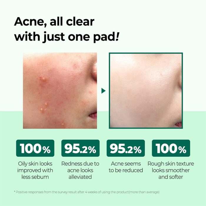 Some By Mi AHA BHA PHA 30 Days Miracle Truecica Clear Pad - Image 3