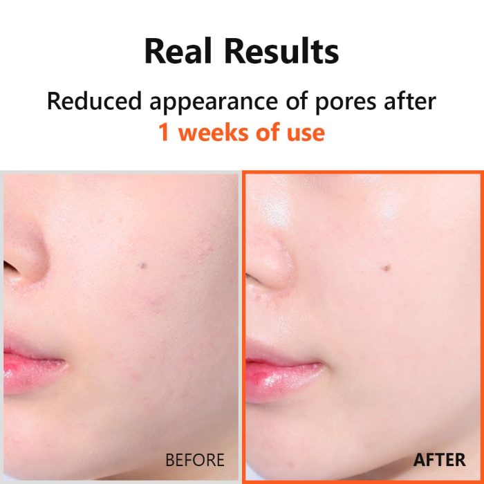 Niacinamide 20 serum.3