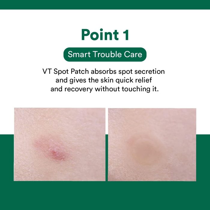 VT spot patch .1