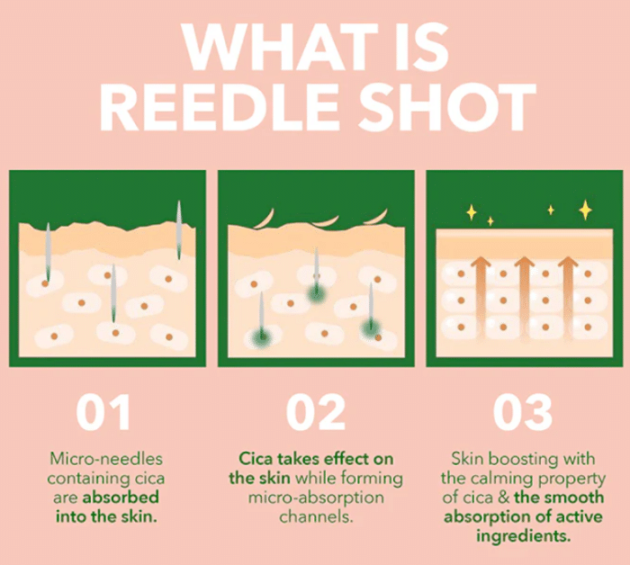 VT Cosmetics Collagen Reedle Shot 300 - Image 4