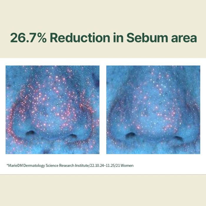 pyun calming serum.4