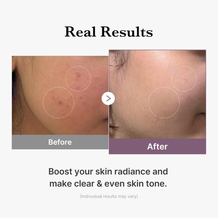Medicube_AGER_Glow_toner_5