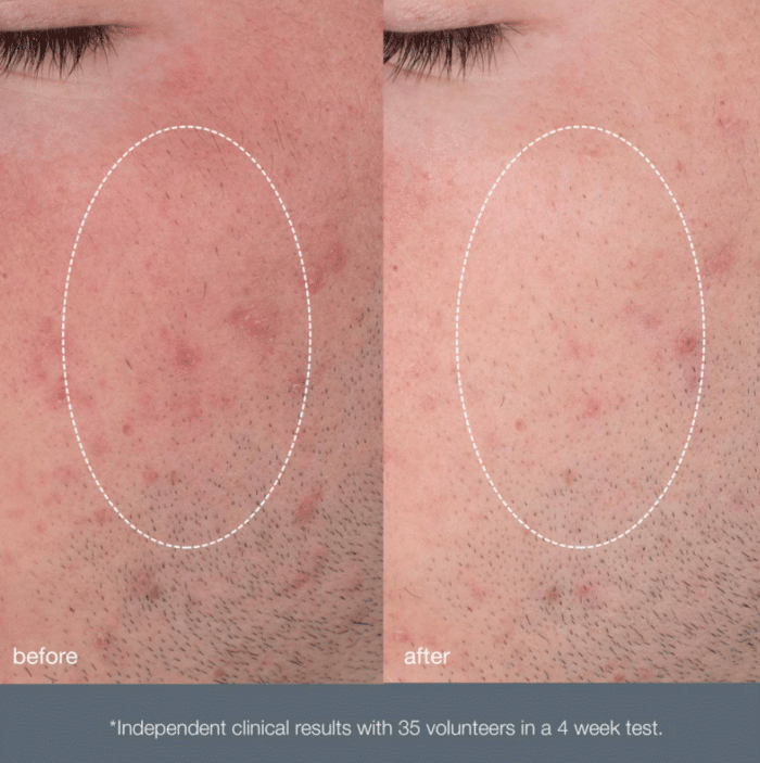 Dermalogica_Daily_microfoliant_4