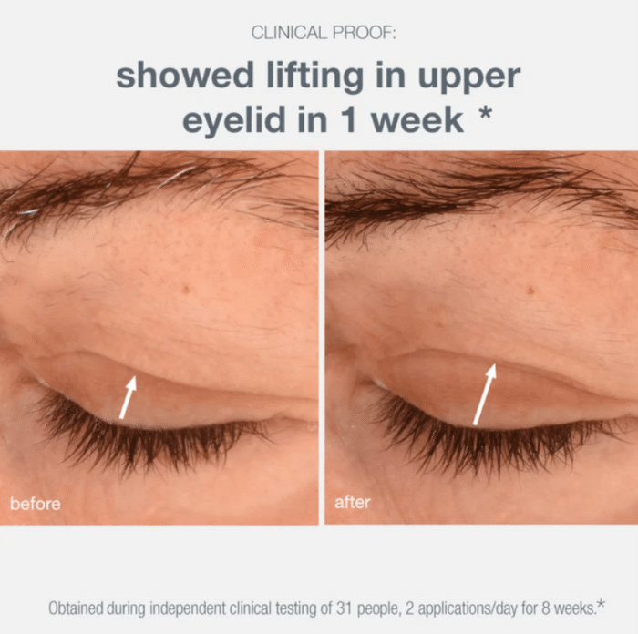 Dermalogica_Phyto_Nature_Lifting_Eye_7