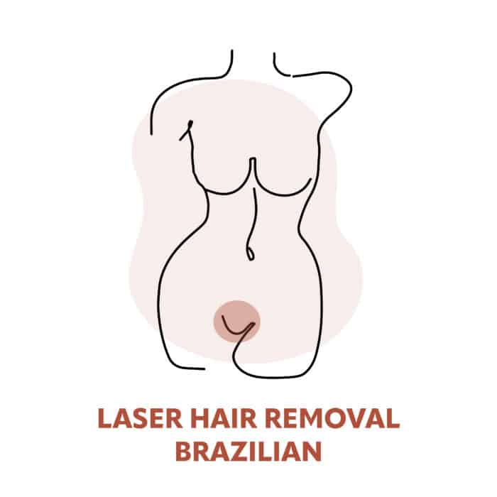 Laser Brazilian