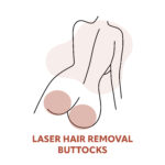 Buttocks Laser Hair Removal Treatments