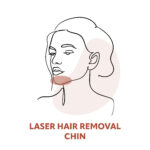 Chin Laser Hair Removal Treatments