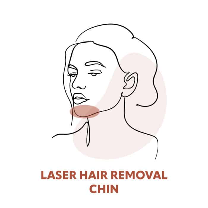 Chin Laser Hair Removal Treatments
