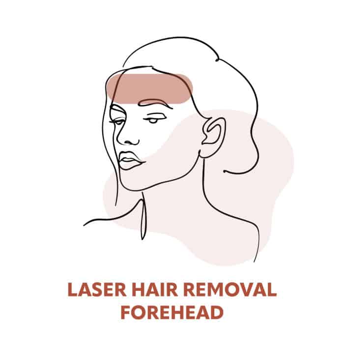 Forehead Laser Hair Removal Treatments