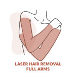 Full Arm Laser Hair Removal Treatments