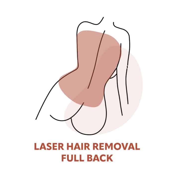 Laser Full Back