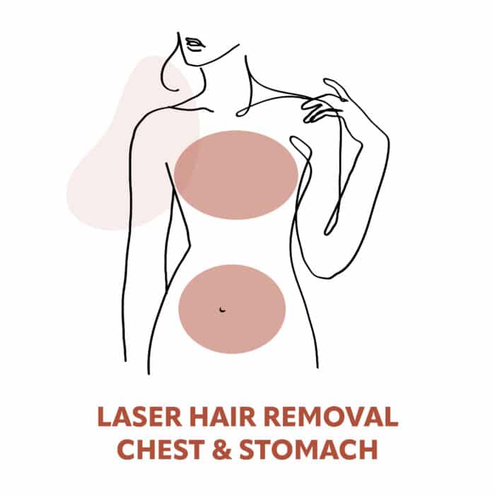 Chest & Stomach Laser Hair Removal Treatments