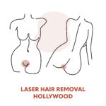 Hollywood Laser Hair Removal Treatments