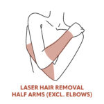 Half Arm Laser Hair Removal Treatments
