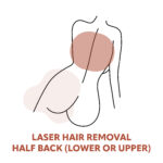 Half-Back Laser Hair Removal Treatments