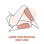 Half Leg Laser Hair Removal Treatments