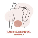 Stomach Laser Hair Removal Treatments