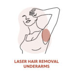 Pain-free Underarm Laser Hair Removal Treatments