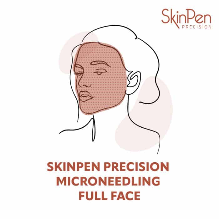 Skinpen Full Face Precision Microneedling Treatments