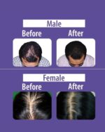 DAENG GI MEO RI Vitalizing Premium Treatment - Image 3