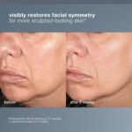 Dermalogica Neurotouch Symmetry Serum - Image 4